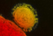 Фото - Врачи выяснили, что антитела к коронавирусу эффективны против инфекций и пищевых аллергенов