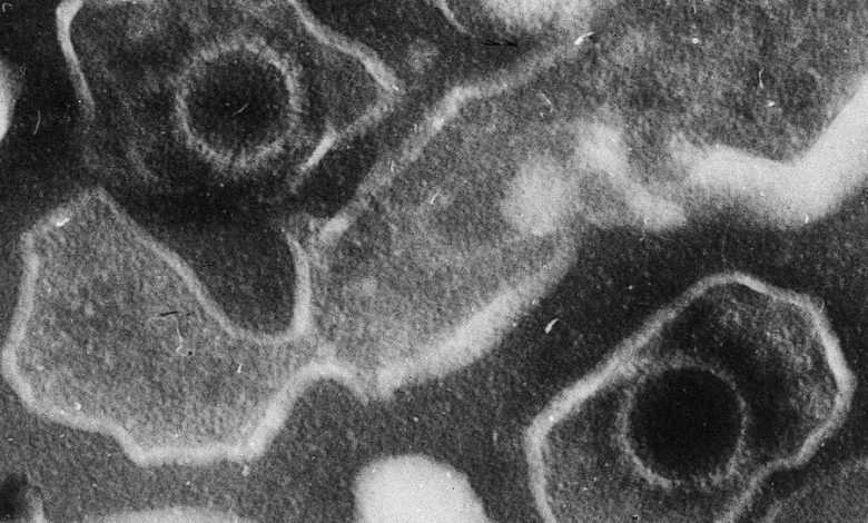 Фото - Ученые приблизились к созданию лекарства от вируса Эпштейна-Барр, которым заражены 95% людей